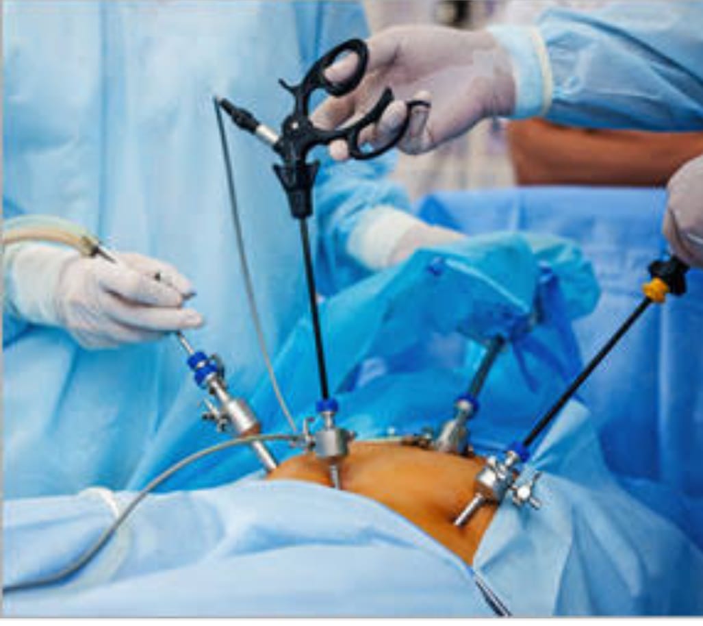 Laparoscopy Surgery (key hole surgeries) by Dr Sheela Chhabra